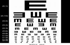 视力0.8正常吗算不算近视